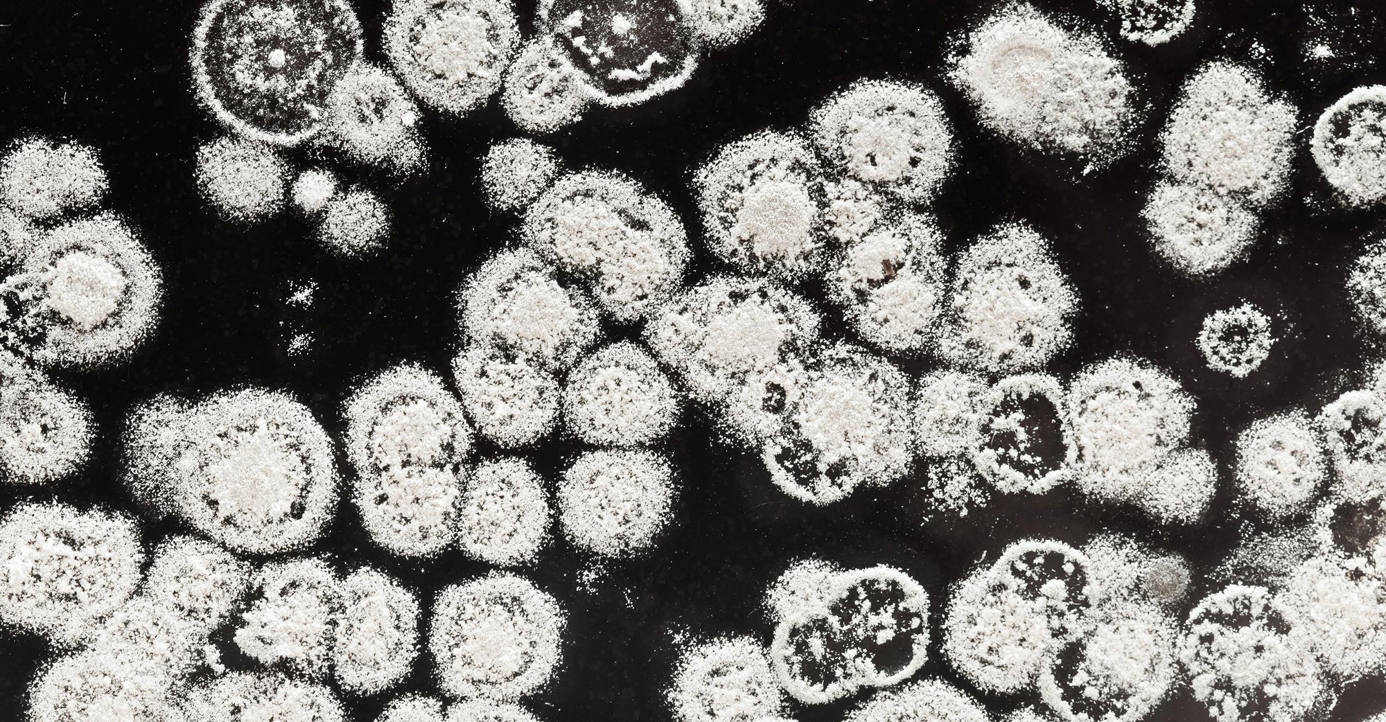 Microscopic image of mold spores
